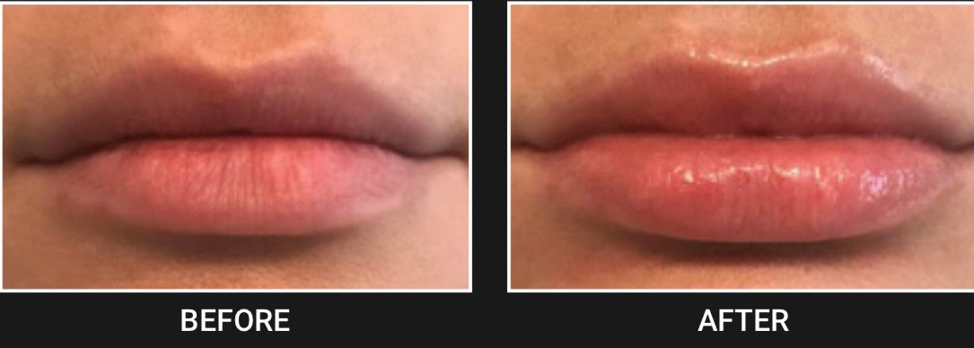 THE PERFECT POUT