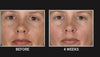 Brightening Defying Pads