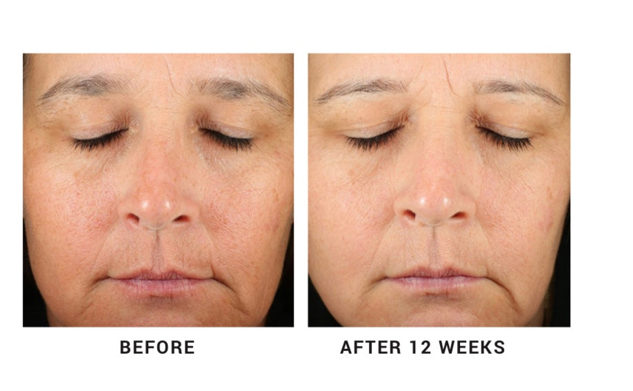 Concentrated Retinol Serum 5X